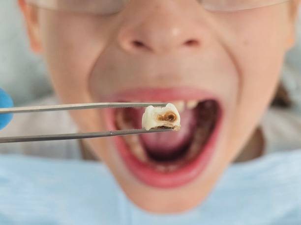 Best Urgent Tooth Repair  in Crete, IL